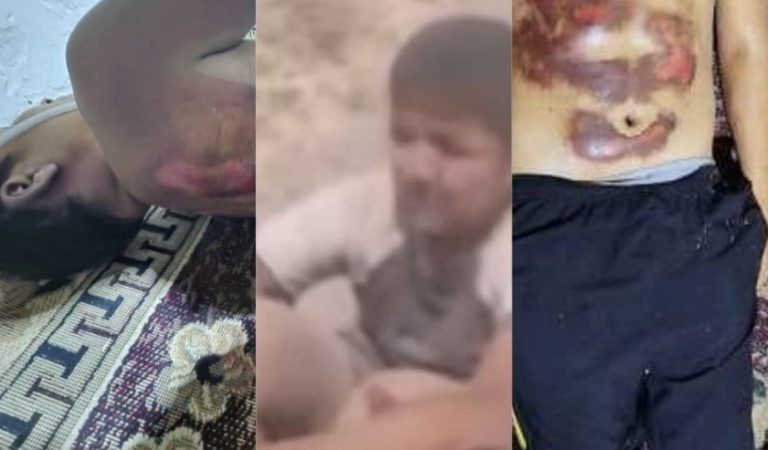 Падар барои шиканҷа ва ба марг расонидани писари 15-солааш боздошт шуд