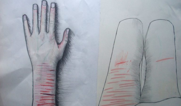 Самоповреждение у подростков: почему дети режут себе руки и как должны реагировать родители. Интервью с семейным психологом Ниссо Азизовой